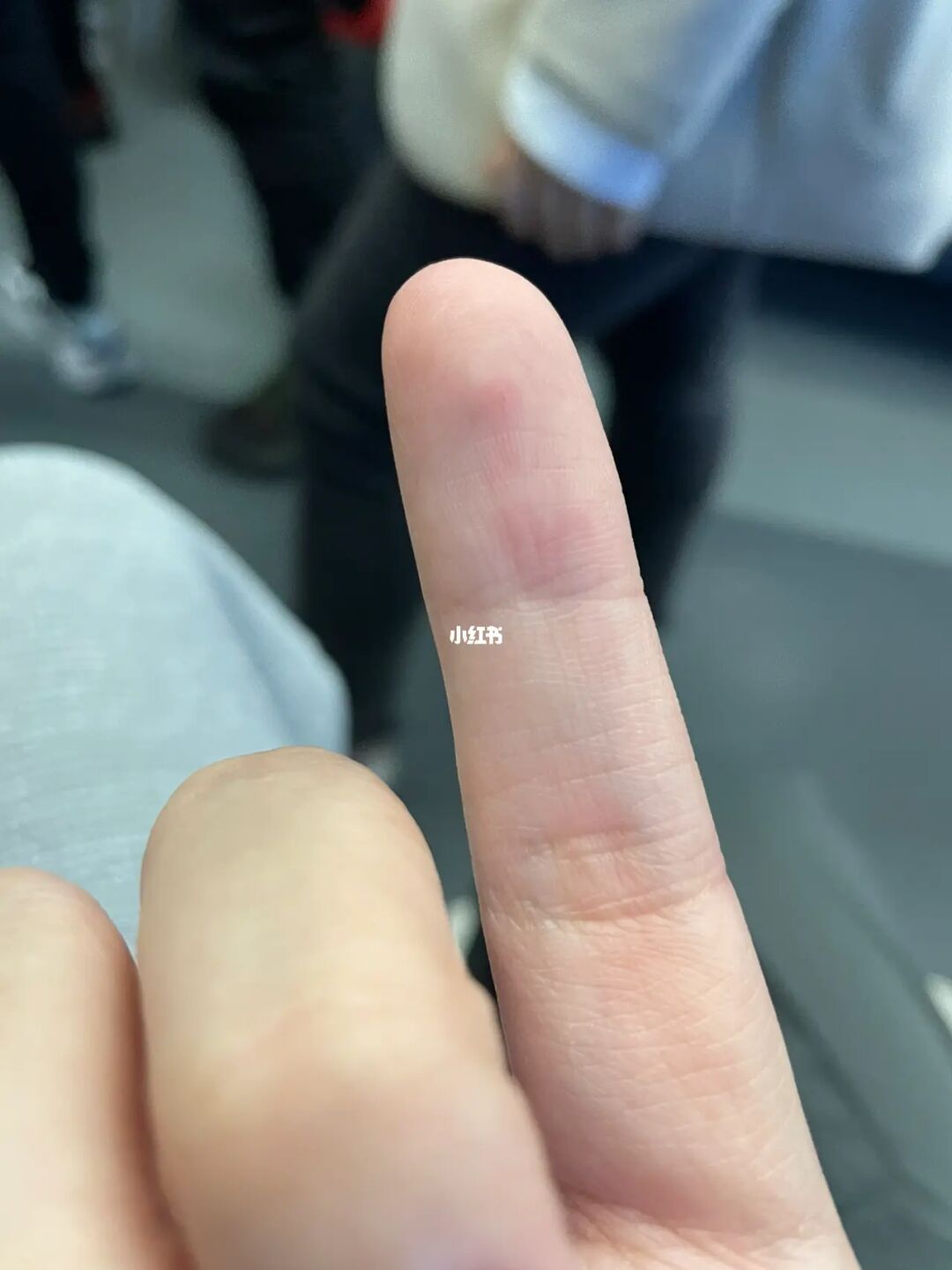 疯狂乱抓_抓狂疯了的图片_疯狂乱抓是谁的技能