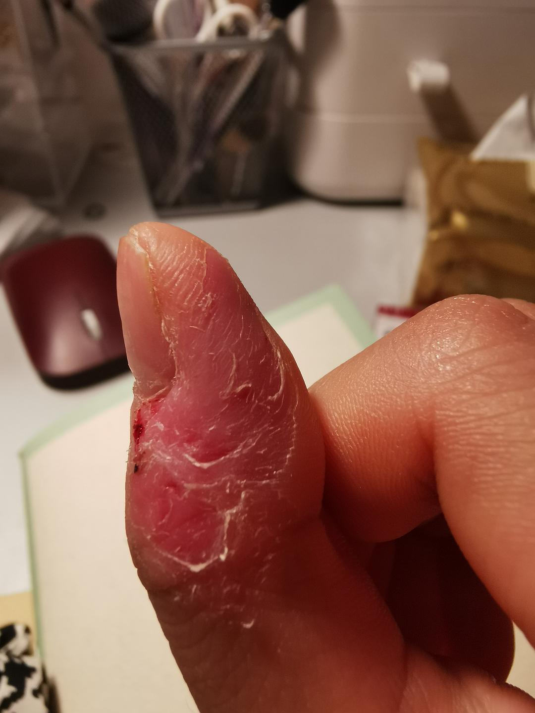 疯狂乱抓_抓狂疯了的图片_疯狂乱抓是谁的技能