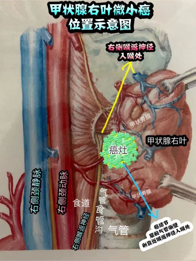 星际战争神经传感器怎么得_星际战甲神经传感器_星际战甲神经传感器前期