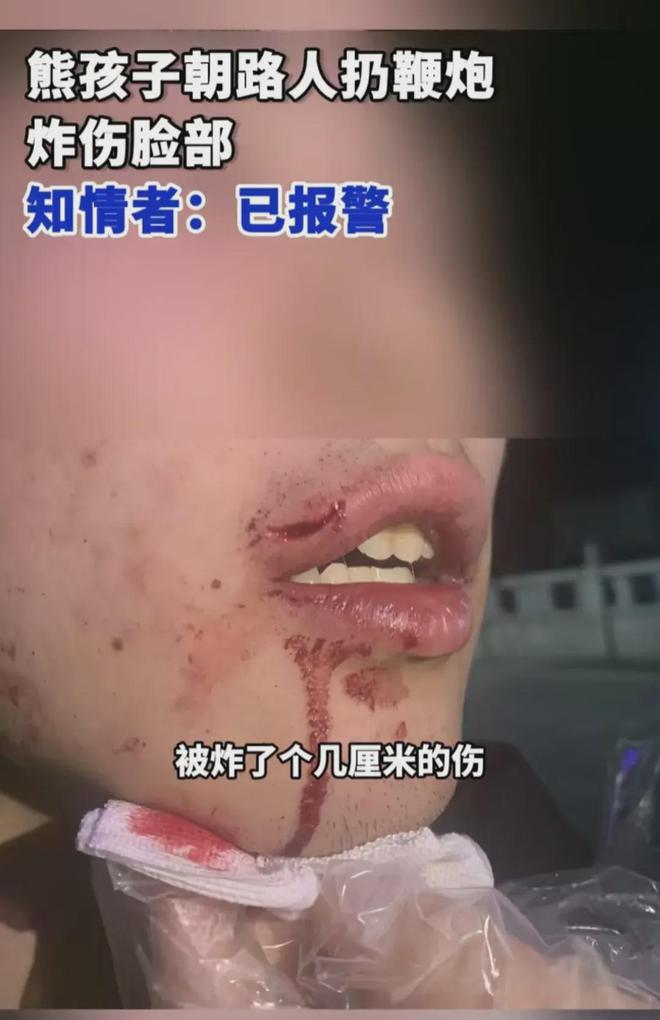 mame怒首领蜂最大往生_怒首领蜂大往生二周_怒首领蜂最大往生